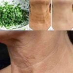 Homemade Mask: Getting Rid of Wrinkles and Spots