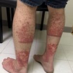 The Real Consequences of Intimacy Without Clarity