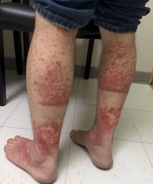 The Real Consequences of Intimacy Without Clarity