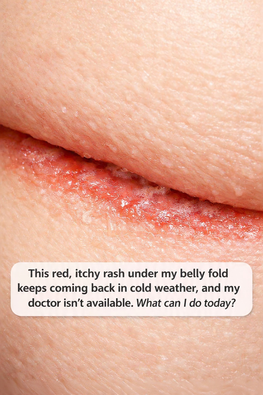 Rash Under Belly Fold: Causes, Treatment, and Prevention