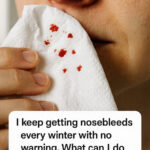 Winter Nosebleeds